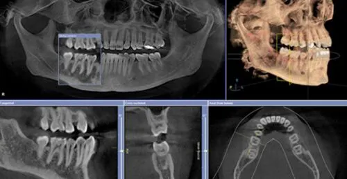 xray example for cbct scanner