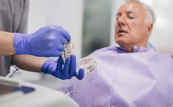 Multiple Dental Implants Replace Several Teeth