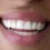 Spring Smile Makeover