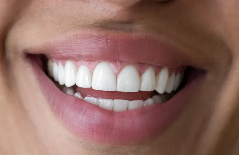 Your Complete Guide to a Spring Smile Makeover