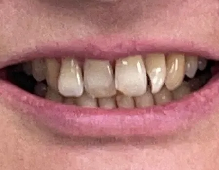 Before