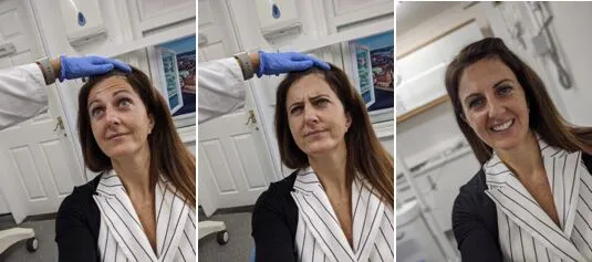 skin treatment journey